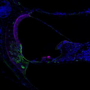 Image of the cochlea with collagen COL4A3/4/5 highlighted.