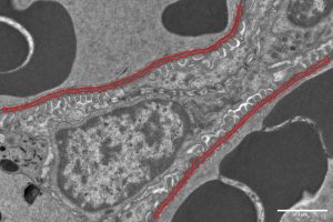 Image of a kidney glomerulus with the GBM highlighted for quantification.