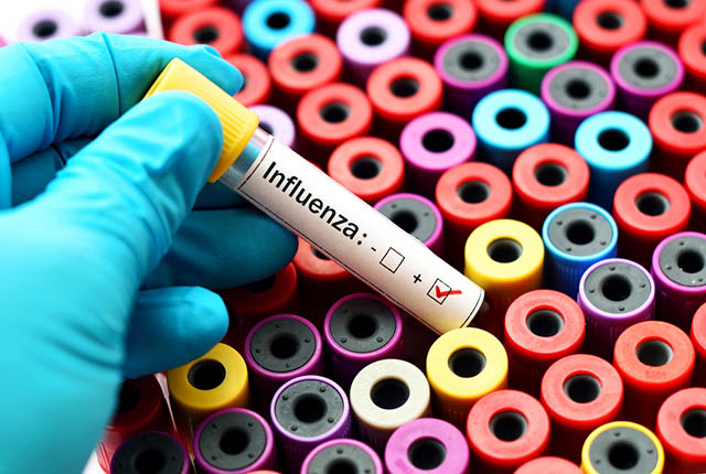 Blood test showing positive for influenza.