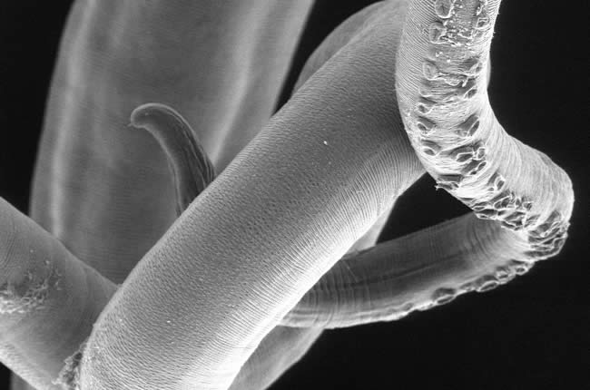 How the whipworm interferes with allergic type responses