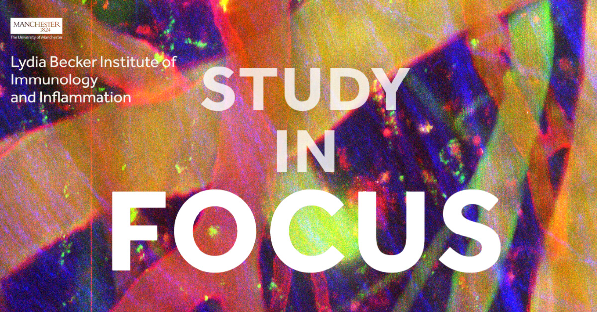 Study in Focus Feature Image Chemokine CXCL4, Lydia Becker Institute of Immunology and Inflammation, The University of Manchester
