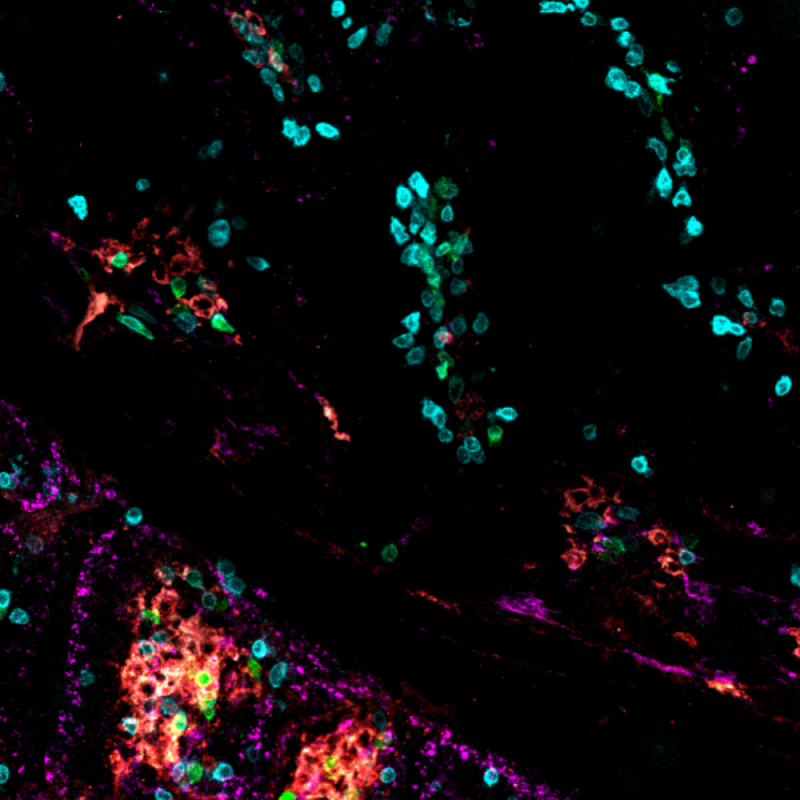 “Image shows immune cells within the gut of a mouse, identified by fluorescence microscopy. Immunoglobulin A (red), T cells (blue), innate lymphoid cells (green) and MHCII (pink). Credit: David Posner and Siyu Ji.”
