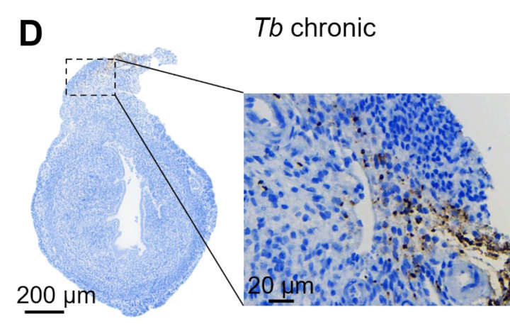 Representative image of immunohistochemistry staining the T. brucei-specific protein BiP in uterine cross section from chronically infected females (scale bar=200 µm; scale bar zoom=20 µm; solid line separate endometrium and myometrium, dashed line separates inner and outer myometrium).