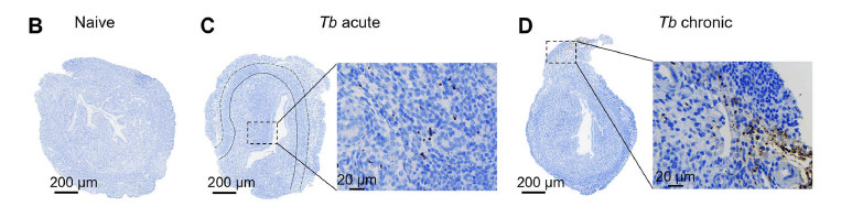 Representative image of immunohistochemistry staining the T. brucei-specific protein BiP in uterine cross section from chronically infected females (scale bar=200 µm; scale bar zoom=20 µm; solid line separate endometrium and myometrium, dashed line separates inner and outer myometrium).