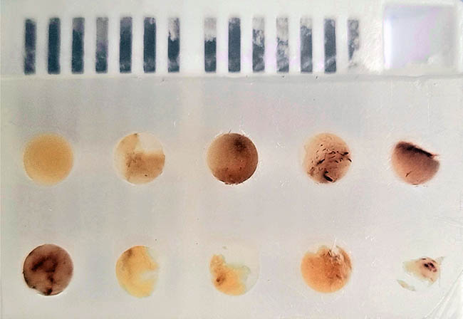 Tissue microarray.