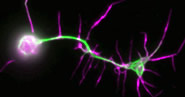 Co-ordinating microtubule dynamics during neuronal development