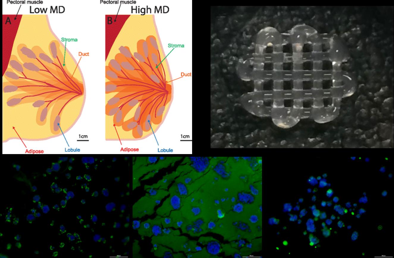 3D Bioprinted tissues for disease and regeneration modelling
