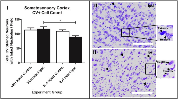 Systemic inflammation affects reperfusion following transient cerebral ischaemia.