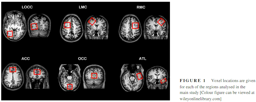 Number of subjects required in common study designs for functional GABA magnetic resonance spectroscopy in the human brain at 3 Tesla