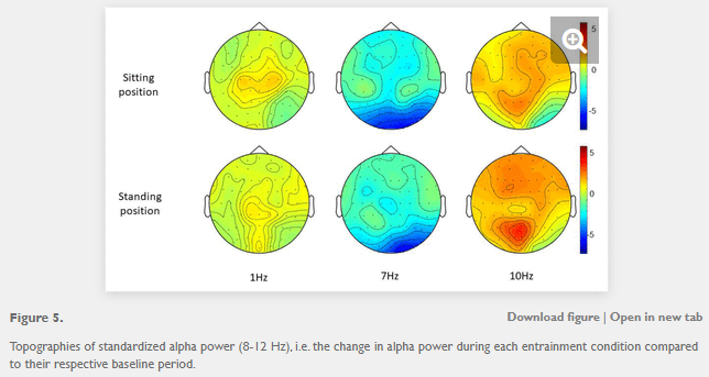 Entraining alpha activity using visual stimulation in patients with chronic musculoskeletal pain. A feasibility study