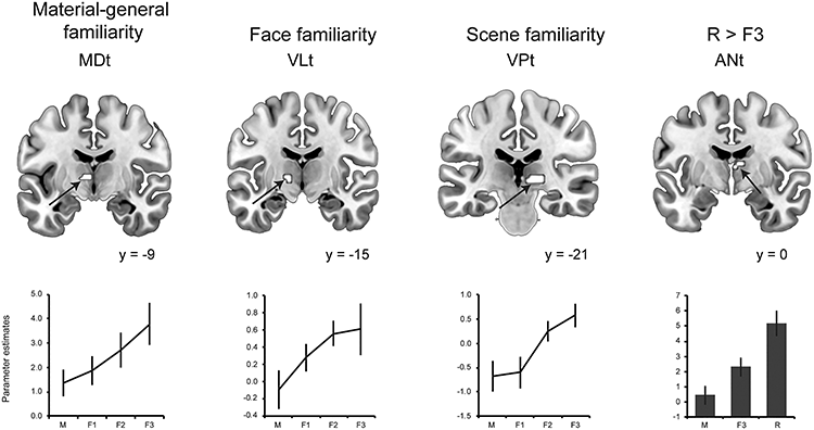 Thalamic-Medial Temporal Lobe Connectivity Underpins Familiarity Memory