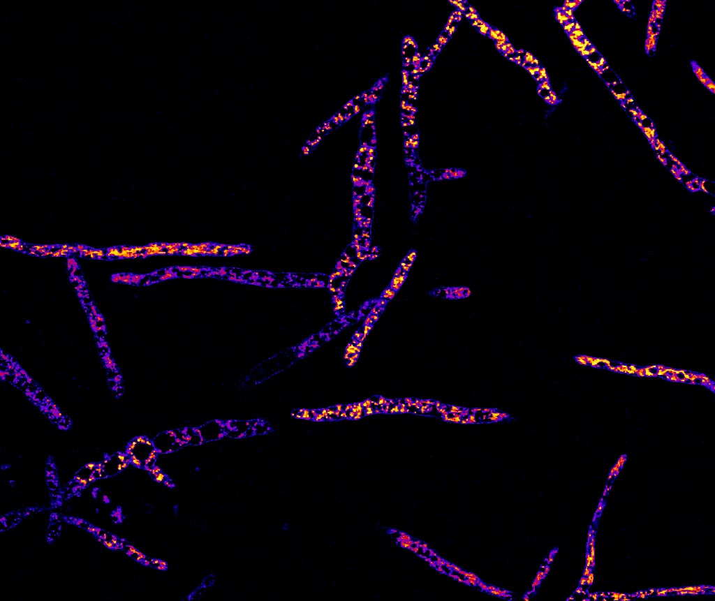 Image of microns